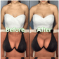 🔥 BUY 1 GET 1 FREE🔥Ultra Boost Inserts || Patented Sticky Fashion Bra Inserts