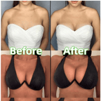🔥 BUY 1 GET 1 FREE🔥Ultra Boost Inserts || Patented Sticky Fashion Bra Inserts