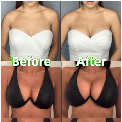 🔥 BUY 1 GET 1 FREE🔥Ultra Boost Inserts || Patented Sticky Fashion Bra Inserts