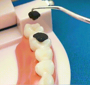 304 Stainless Steel Toothpick Oral Care Cleaning Tool