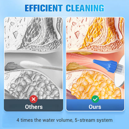 📢📢BIG SALE!!⏰👂 Ear Wax Removal Kit – Safe, Gentle & Reusable Silicone Spoon for Easy, Hygienic Ear Cleaning ✨🛡️